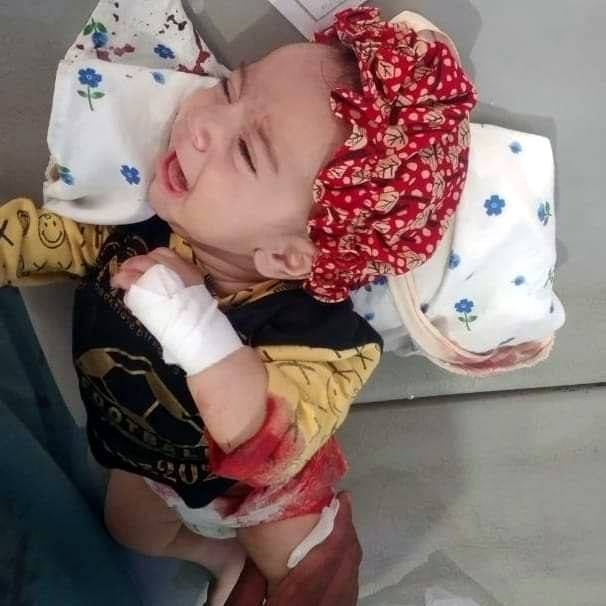One year old wounded in Herat